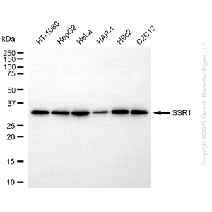 KD-Validated SSR1 Rabbit mAb (20 μl)