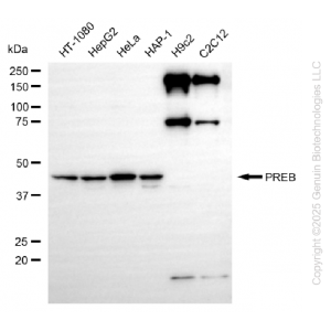 KD-Validated PREB Rabbit mAb (20 μl)