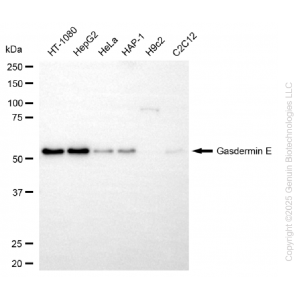KD-Validated GSDME Rabbit mAb (20 μl)