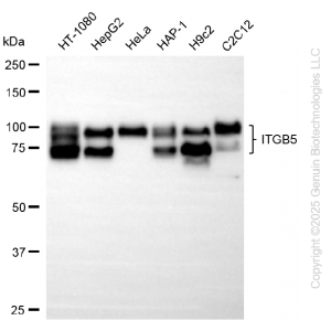 KD-Validated ITGB5 Rabbit mAb (20 μl)