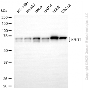KD-Validated KRIT1 Rabbit mAb (20 μl)