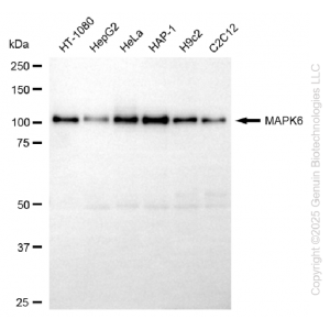 KD-Validated MAPK6 Rabbit mAb (20 μl)