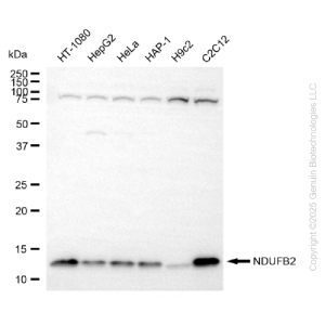 65582-WB-1-300×300-1.webp KD-Validated NDUFB2 Rabbit mAb (20 μl)