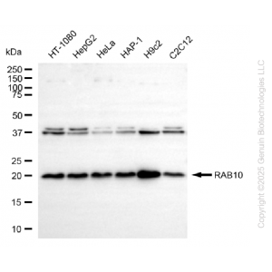 KD-Validated RAB10 Rabbit mAb (20 μl)