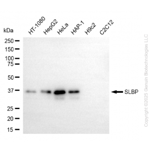 KD-Validated SLBP Rabbit mAb (20 μl)