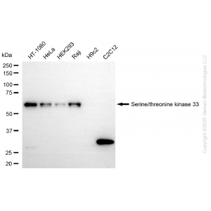 KD-Validated STK33 Rabbit mAb (20 μl)