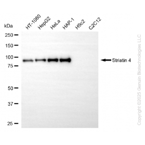 KD-Validated STRN4 Rabbit mAb (20 μl)
