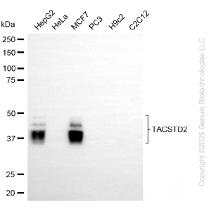 KD-Validated TACSTD2 Rabbit mAb (20 μl)
