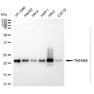 KD-Validated TMEM9B Rabbit mAb (20 μl)