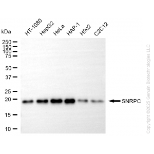 KD-Validated SNRPC Rabbit mAb (20 μl)