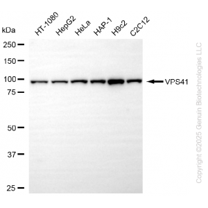 KD-Validated VPS41 Rabbit mAb (20 μl)