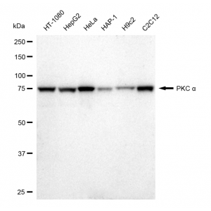 KD-Validated PKC alpha Rabbit mAb (20 μl)