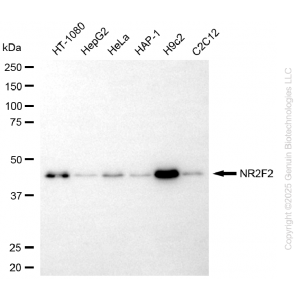 KD-Validated NR2F2 Rabbit mAb (20 μl)