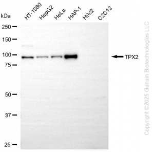 KD-Validated TPX2 Rabbit mAb (20 μl)