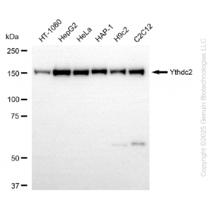 KD-Validated YTHDC2 Rabbit mAb (20 μl)