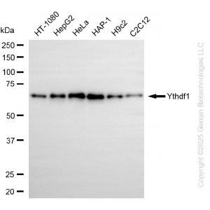 KD-Validated YTHDF1 Rabbit mAb (20 μl)