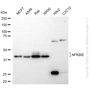 KD-Validated NFKBIE Rabbit mAb (20 μl)