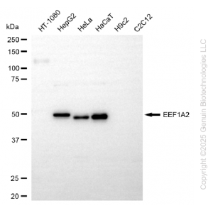 KD-Validated EEF1A2 Rabbit mAb (20 μl)