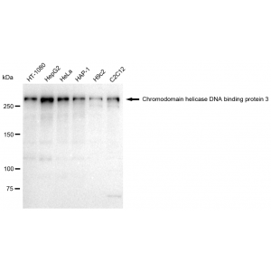 KD-Validated ZFH Rabbit mAb (20 μl)