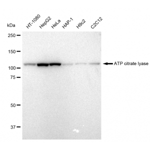 KD-Validated ACL Rabbit mAb (20 μl)