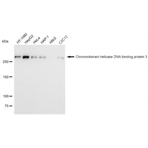 KD-Validated ZFH Rabbit mAb (20 μl)