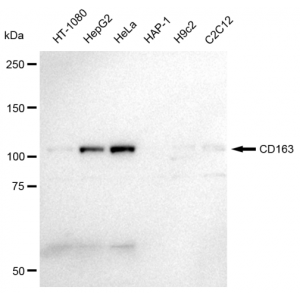 KD-Validated CD163 Rabbit mAb (20 μl)