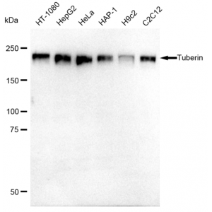 KD-Validated Tuberin Rabbit mAb (20 μl)