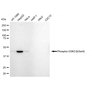 KD-Validated Phospho-GSK3B (Ser9) Rabbit mAb (20 μl)