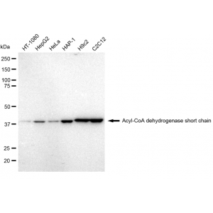 KD-Validated ACAD3 Rabbit mAb (20 μl)