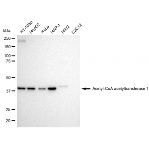 KD-Validated ACAT Rabbit mAb (20 μl)