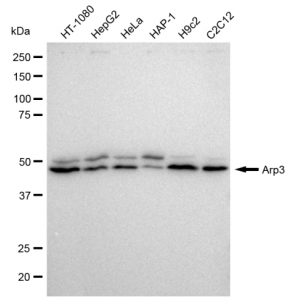 KD-Validated Arp3 Rabbit mAb (20 μl)