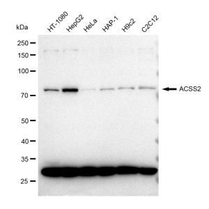 KD-Validated ACSS2 Rabbit mAb (20 μl)