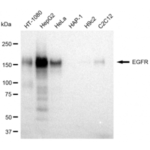 KD-Validated EGFR Rabbit mAb (20 μl)