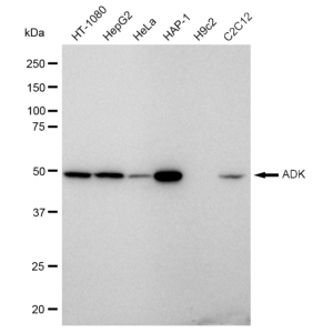 KD-Validated ADK Rabbit mAb (20 μl)