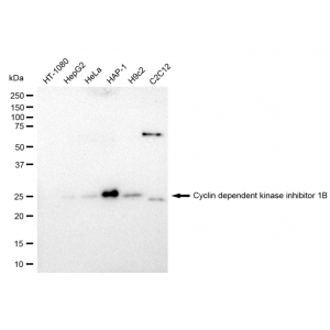 KD-Validated CDKN1B Rabbit mAb (20 μl)