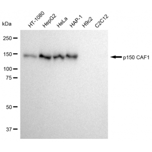 KD-Validated p150 CAF1 Rabbit mAb (20 μl)