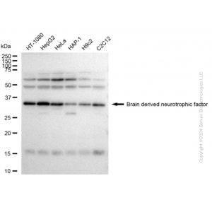 KD-Validated BDNF Rabbit mAb (20 μl)