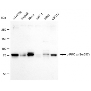 KD-Validated Phospho-PKC alpha (Ser657) Rabbit mAb (20 μl)