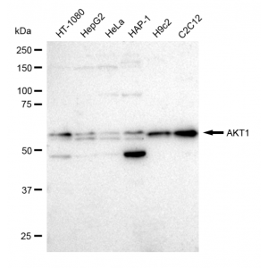 KD-Validated AKT1 Rabbit mAb (20 μl)