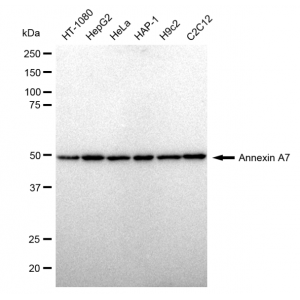 KD-Validated ANX7 Rabbit mAb (20 μl)