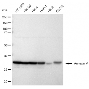KD-Validated ANX5 Rabbit mAb (20 μl)