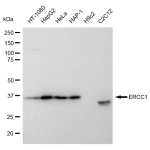 KD-Validated ERCC1 Rabbit mAb (20 μl)