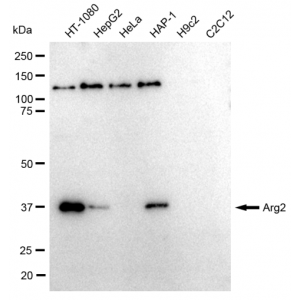 KD-Validated Arg2 Rabbit mAb (20 μl)