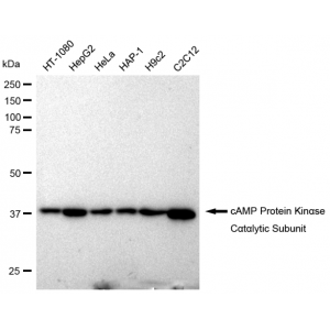 KD-Validated PKACA Rabbit mAb (20 μl)