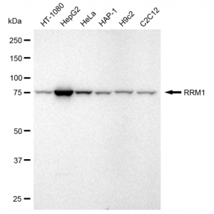 KD-Validated RRM1 Rabbit mAb (20 μl)