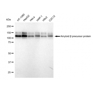 KD-Validated ABPP Rabbit mAb (20 μl)
