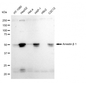 KD-Validated ARRB1 Rabbit mAb (20 μl)
