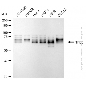 KD-Validated TFE3 Rabbit mAb (20 μl)