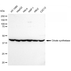 KD-Validated Citrate Synthetase Rabbit mAb (20 μl)