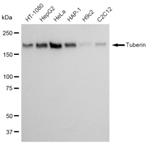 KD-Validated Tuberin Rabbit mAb (20 μl)